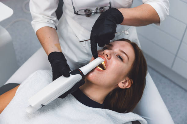 Best Emergency Root Canal Treatment in Santa Clara, CA